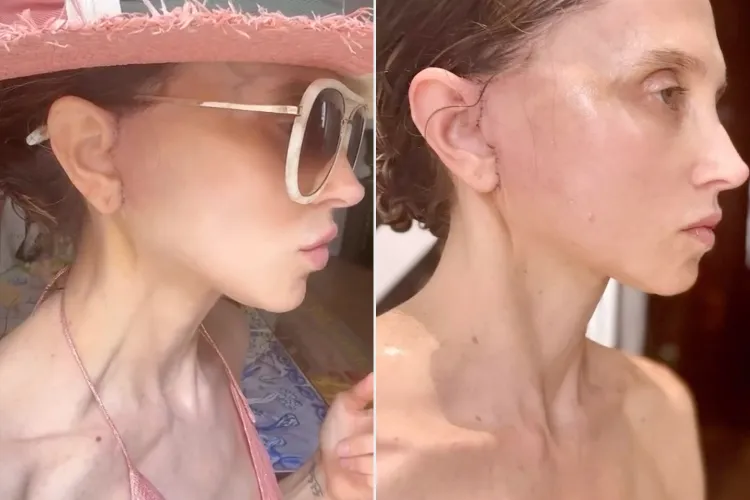 Stacy-Bendet-facelift-072125-tout-03-563bfea540fd4b17aeb808ee676f2567